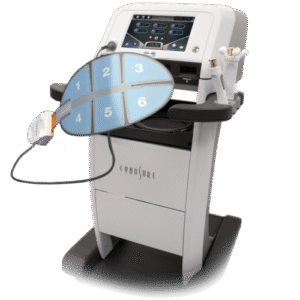 Cynosure Vectus laser machine for professional hair removal treatments