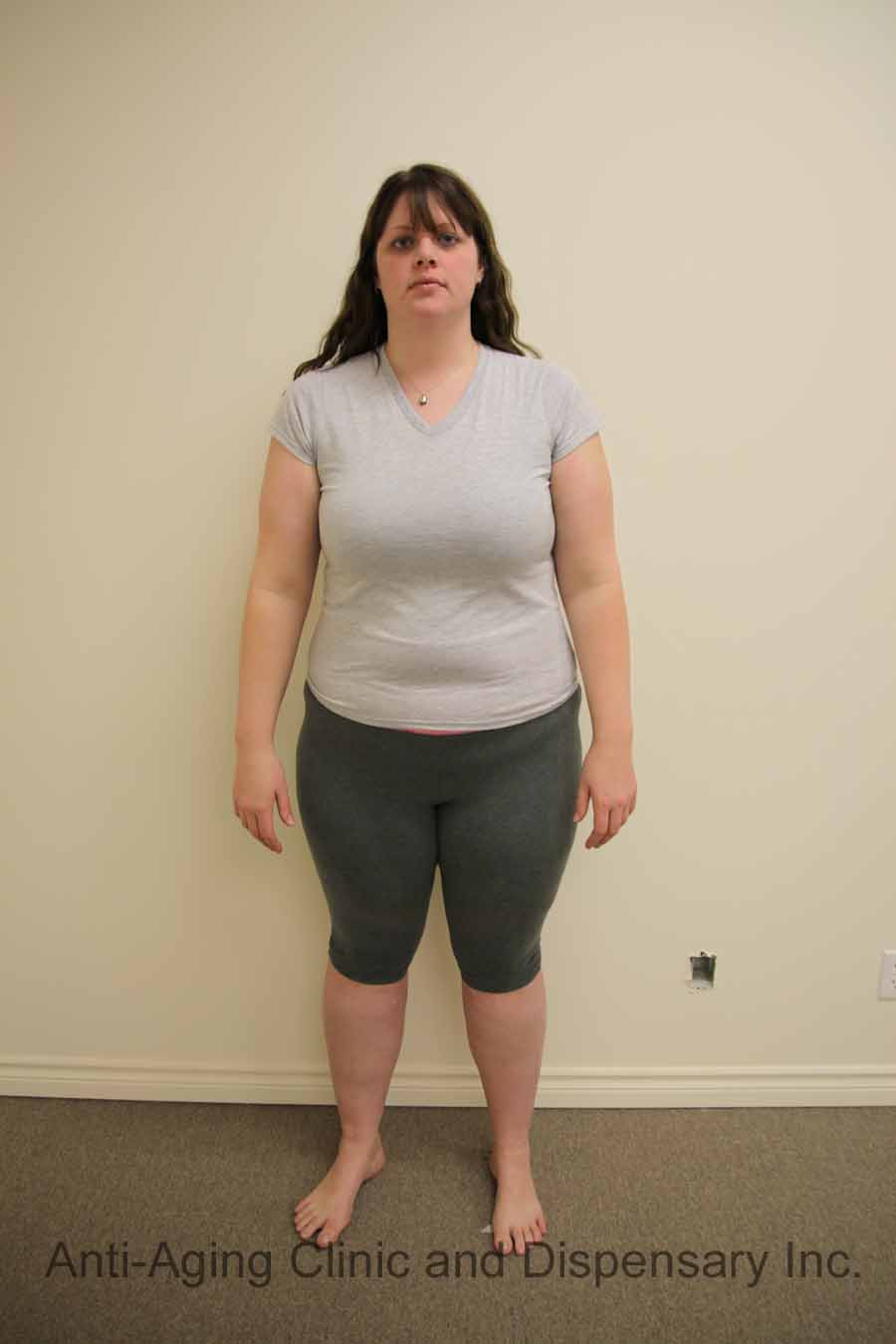 Woman standing in fitness wear against a clinic wall
