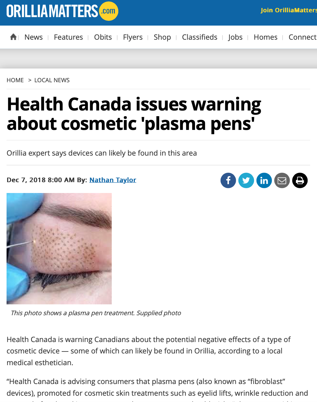 Health Canada warning about cosmetic plasma pens