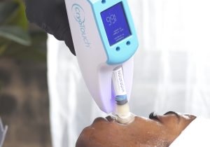 Cryotherapy facial treatment using CyroTouch device
