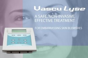 Vascu Lyse non-invasive treatment device for skin blemishes