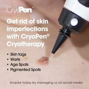 CryoPen cryotherapy treating skin imperfections like tags, warts, and age spots